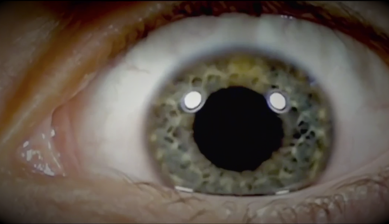 oeil_Hardcore